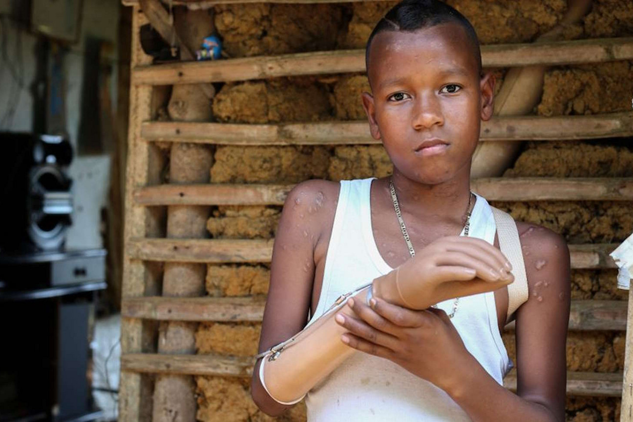 Minenopfer-Kolumbien-Jemerson_Vasquez