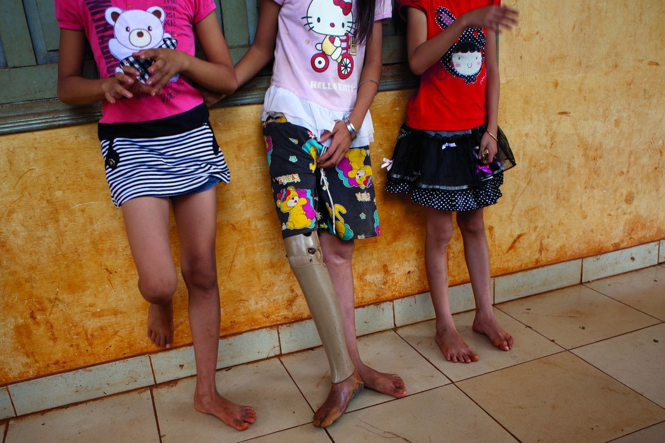 Drei Kinder vom Kopf abwärts, das mittlere hat eine Beinprothese nach einem Streubombenunfall.